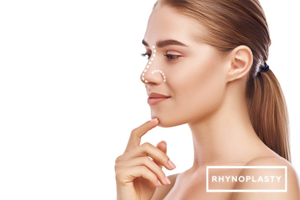 Rhinoplasty in Riyadh